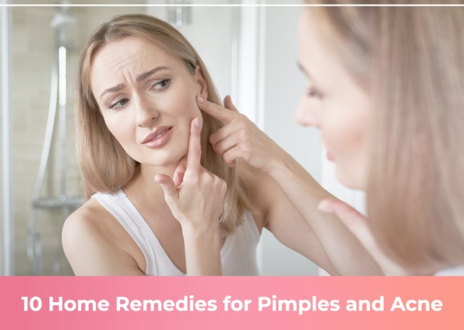 10 Home Remedies for Pimples and Acne
