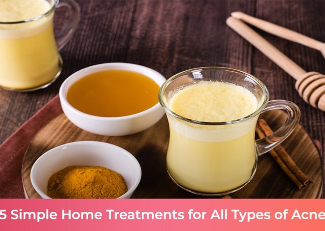 Simple Home treatments for all types of acne