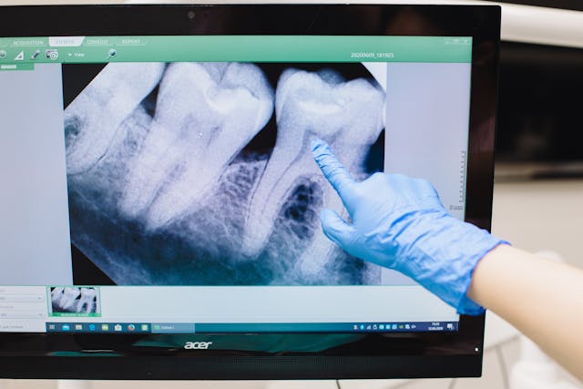 Beyond Fillings: New Tooth Restoration Options Explained