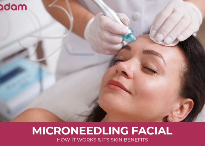 Microneedling Facial: How it Works and its Skin Benefits