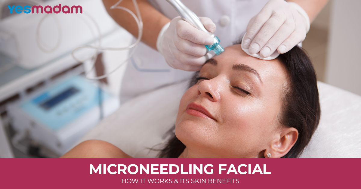 Microneedling Facial: How it Works and its Skin Benefits