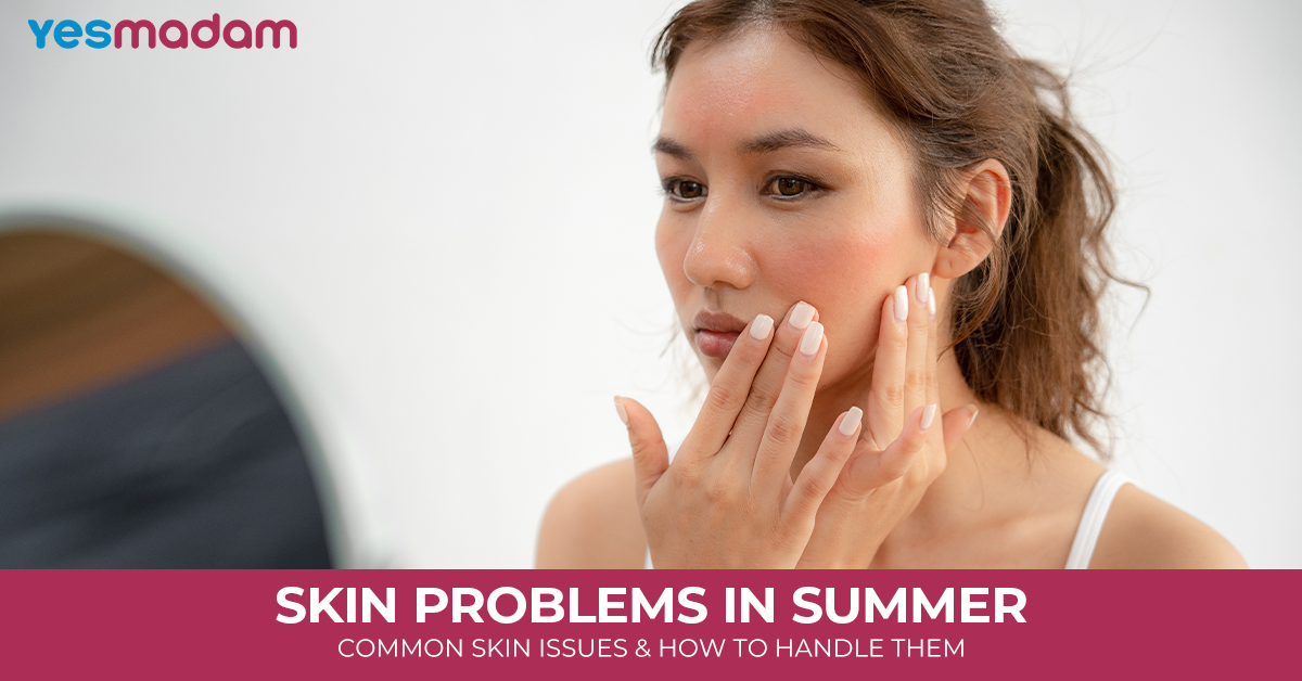 Skin Problems in Summer: Common Skin Issues and How to Handle Them