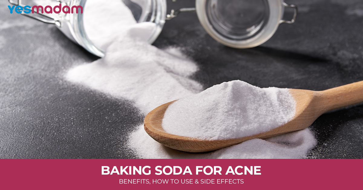 Baking Soda for Acne: Benefits, How to Use, and Side Effects