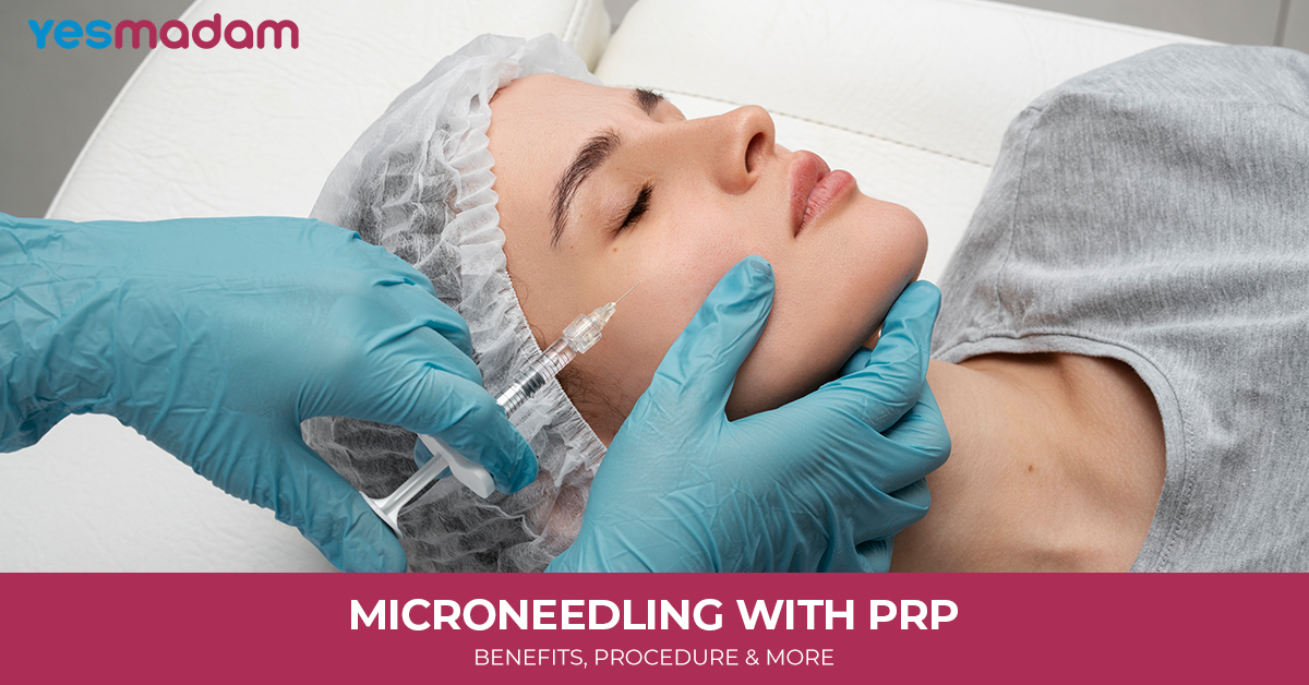 Microneedling with PRP: Benefits, Procedure, and More