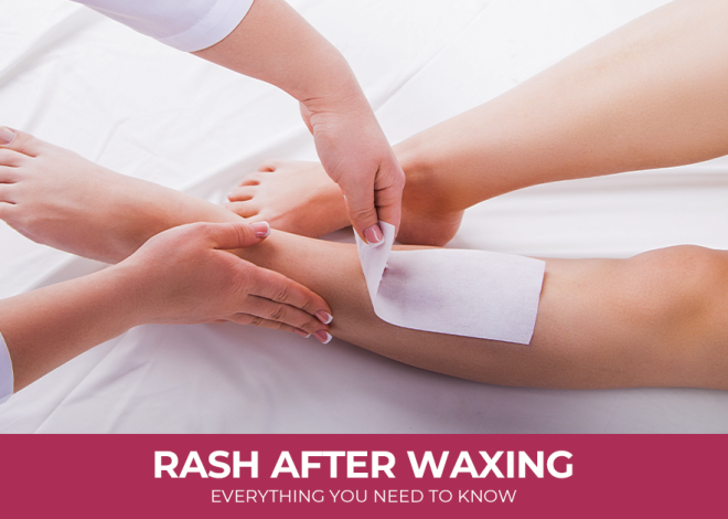 Rash After Waxing: Everything You Need To Know