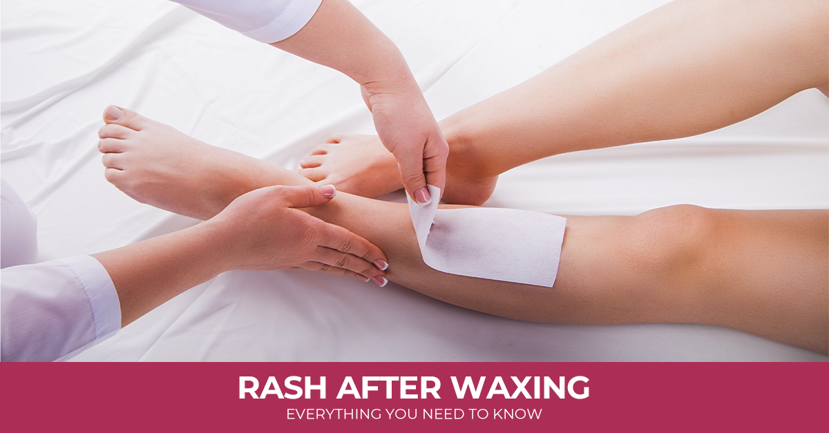 Rash After Waxing: Everything You Need To Know
