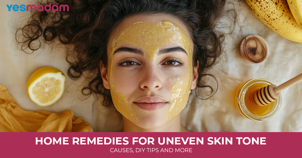 Home Remedies for Uneven Skin Tone: Causes, DIY Tips and More