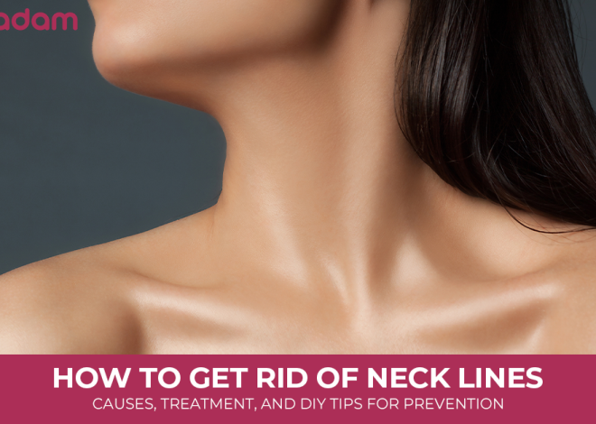 How to Get Rid of Neck Lines: Causes, Treatment, and DIY Tips for Prevention