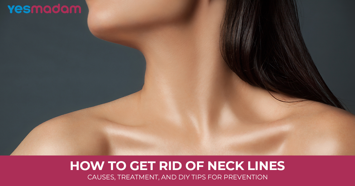 How to Get Rid of Neck Lines: Causes, Treatment, and DIY Tips for Prevention