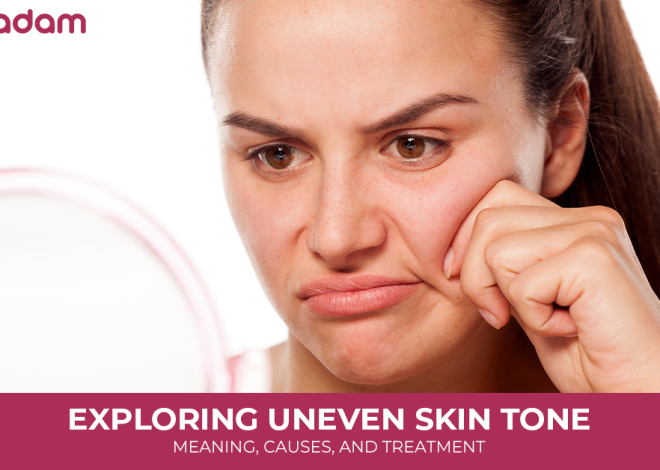 Exploring Uneven Skin Tone Meaning, Causes, and Treatment