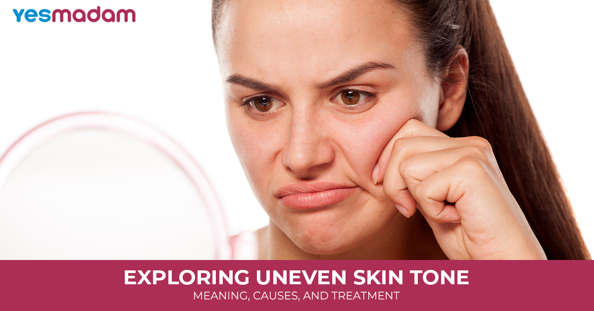 Exploring Uneven Skin Tone Meaning, Causes, and Treatment