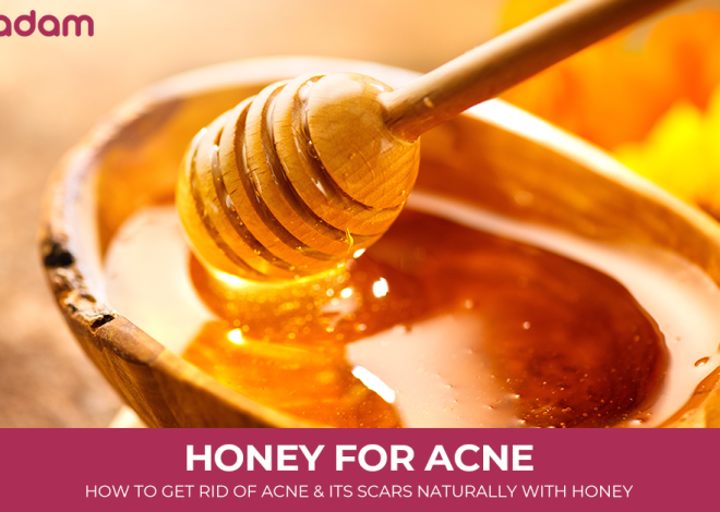 Honey for Acne: How to Get Rid of Acne and its Scars Naturally with Honey