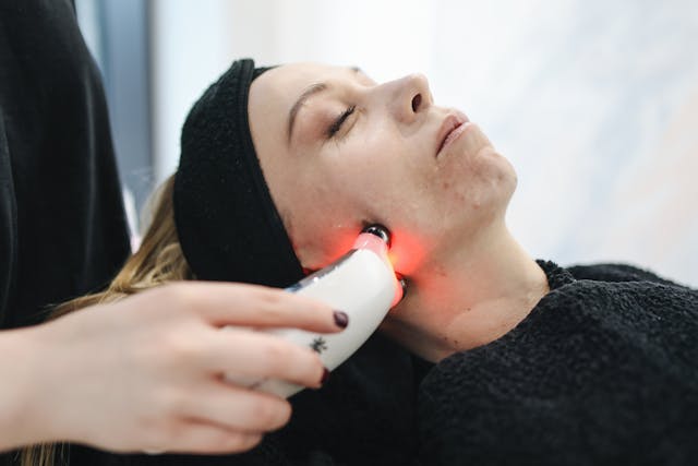 Holistic Approaches To Acne Treatment: From Diet To Dermatology