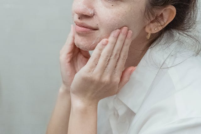 How To Prepare For Microneedling If You Have Sensitive Skin