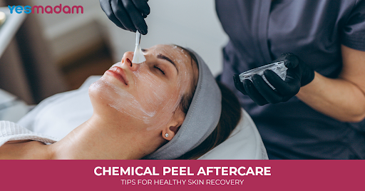 Chemical Peel Aftercare: Tips for Healthy Skin Recovery