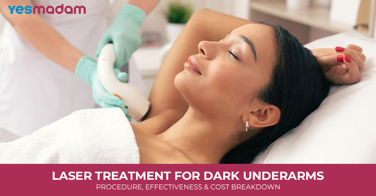 Laser Treatment for Dark Underarms: Procedure, Effectiveness & Cost Breakdown