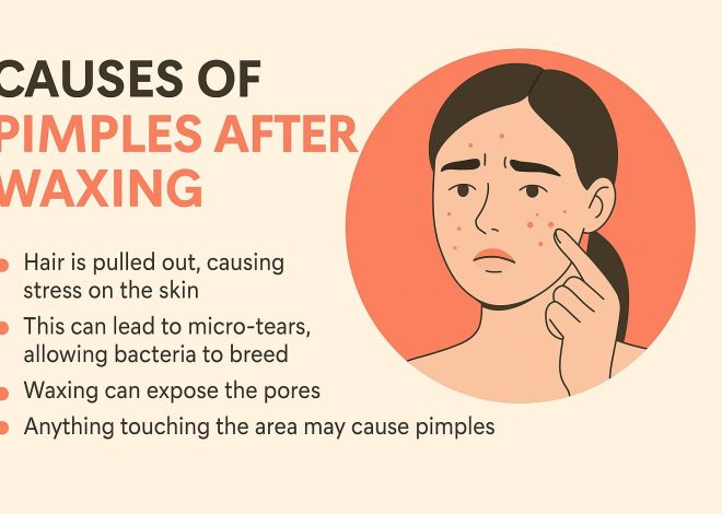 Pimples After Waxing? Here’s How to Calm Your Skin