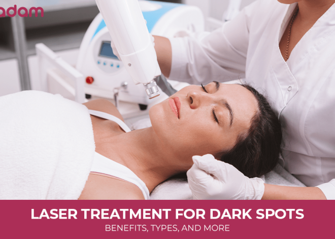 Laser Treatment for Dark Spots: Benefits, Types, and More
