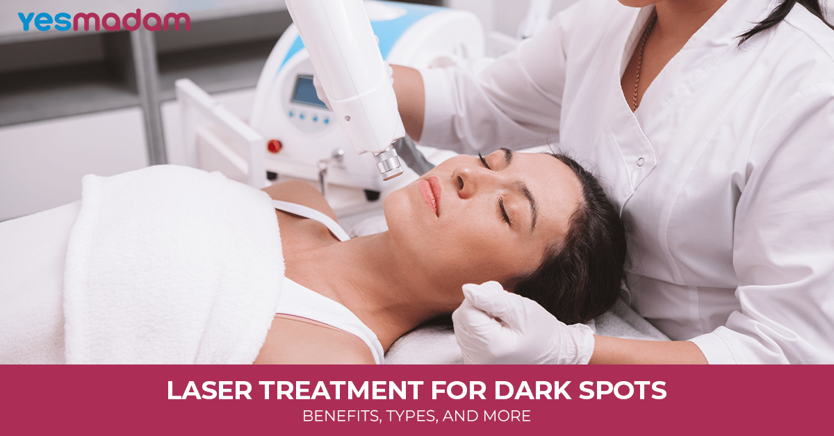Laser Treatment for Dark Spots: Benefits, Types, and More