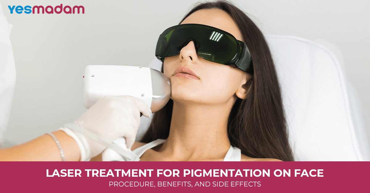 Laser Treatment for Pigmentation on Face: Procedure, Benefits, and Side Effects