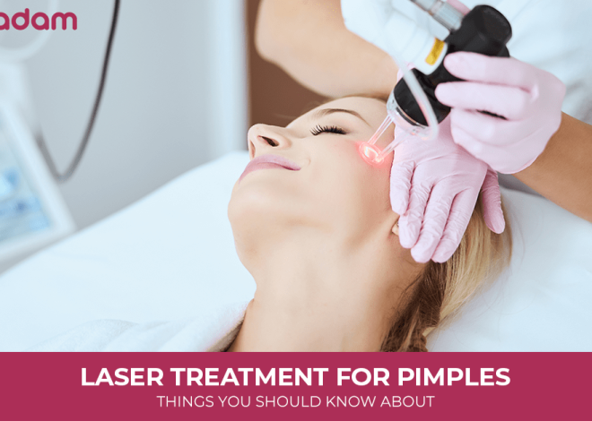 Laser Treatment for Pimples: Things You Should Know About