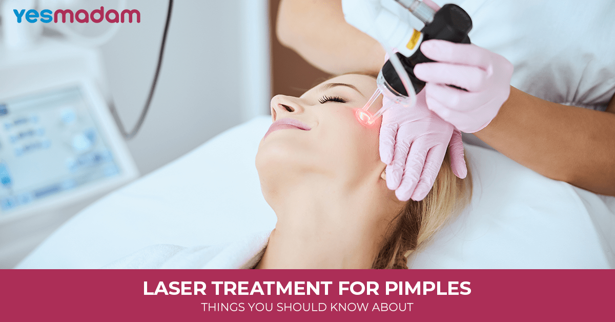 Laser Treatment for Pimples: Things You Should Know About