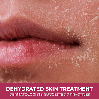 Dehydrated Skin Treatment: Dermatologists’ Suggested 7 Practices