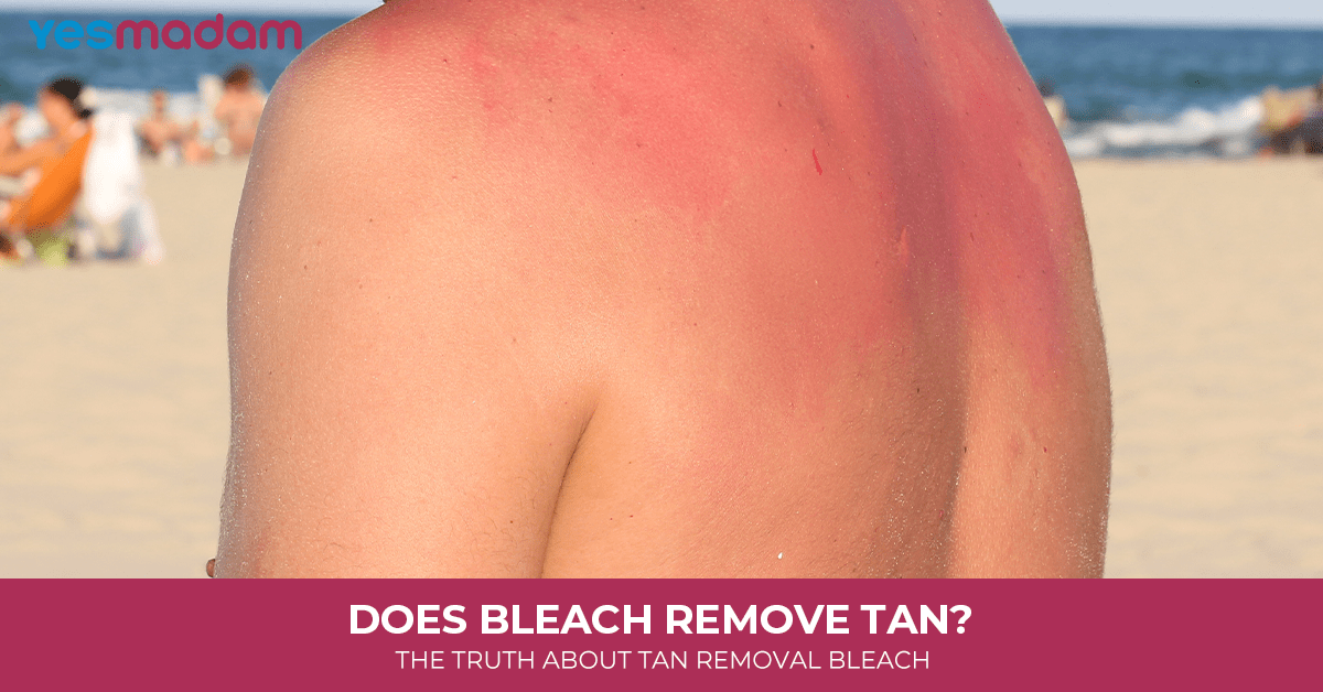 Does Bleach Remove Tan? The Truth About Tan Removal Bleach