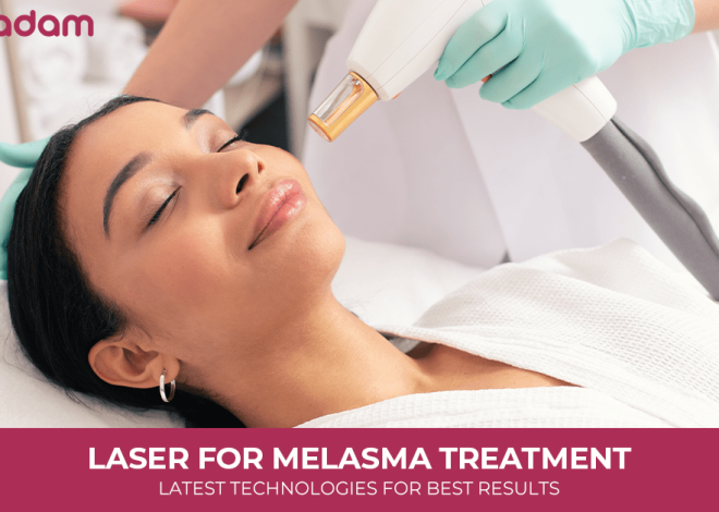 Laser for Melasma Treatment: Latest Technologies for Best Results