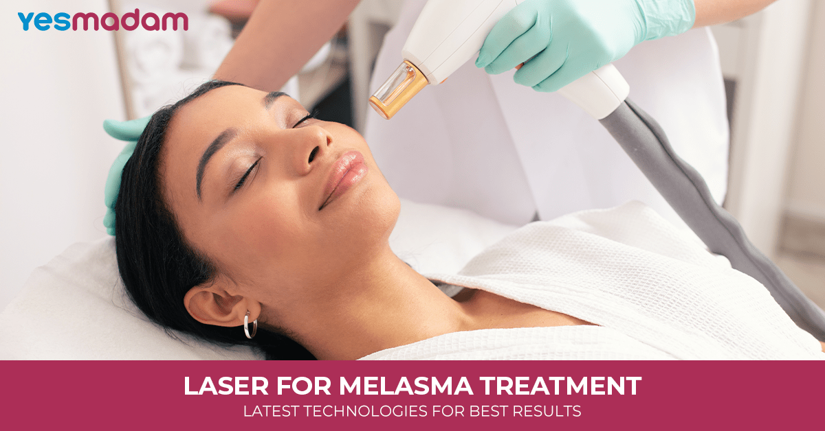 Laser for Melasma Treatment: Latest Technologies for Best Results