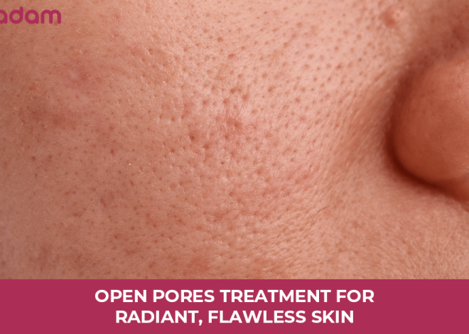 Open Pores Treatment for Radiant, Flawless Skin
