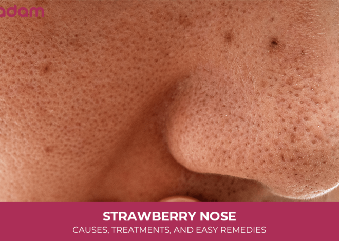 Strawberry Nose: Causes, Treatments, and Easy Remedies