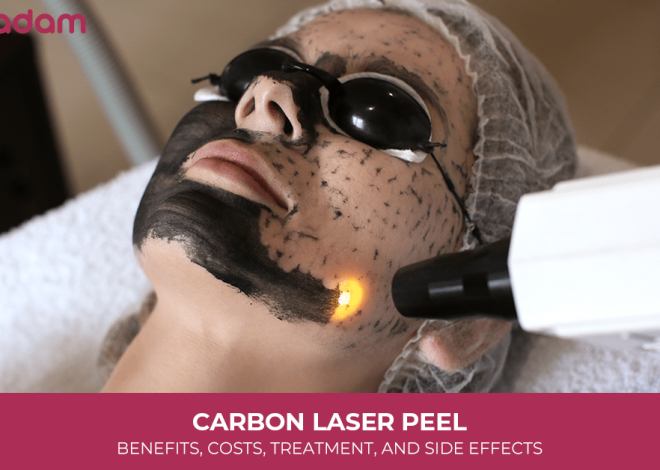 Carbon Laser Peel: Benefits, Costs, Treatment, and Side Effects