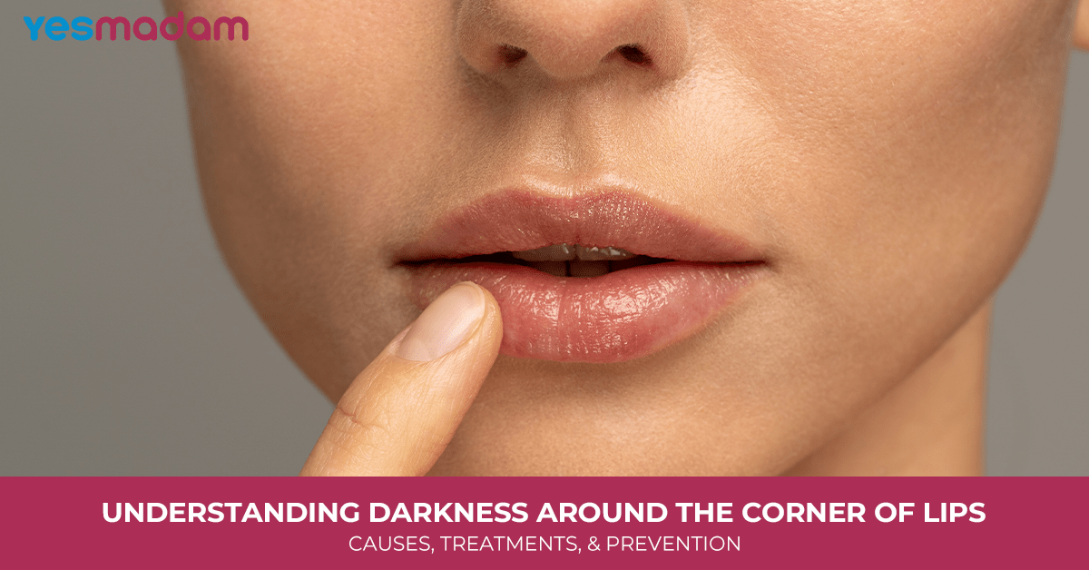 Understanding Darkness Around the Corner of Lips: Causes, Treatments, & Prevention
