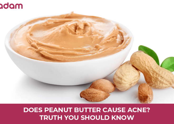 Does Peanut Butter Cause Acne? Truth You Should Know