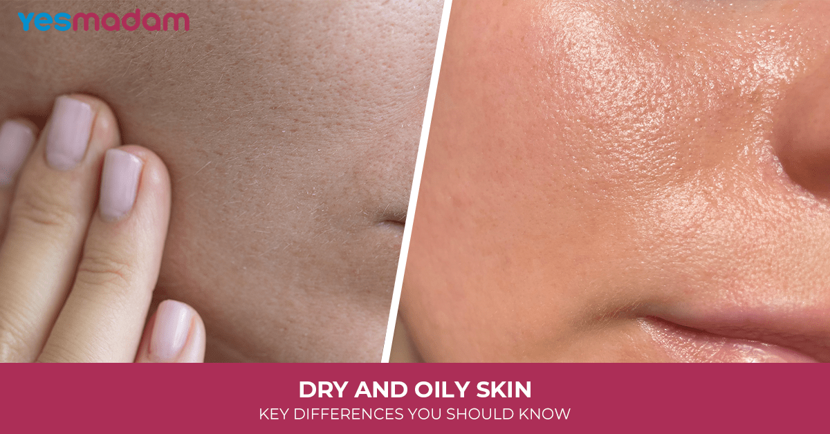 Dry and Oily Skin: Key Differences You Should Know