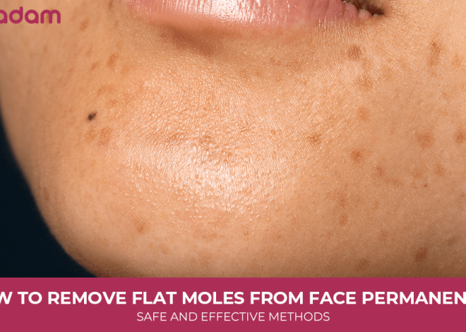 How to Remove Flat Moles From Face Permanently: Safe and Effective Methods