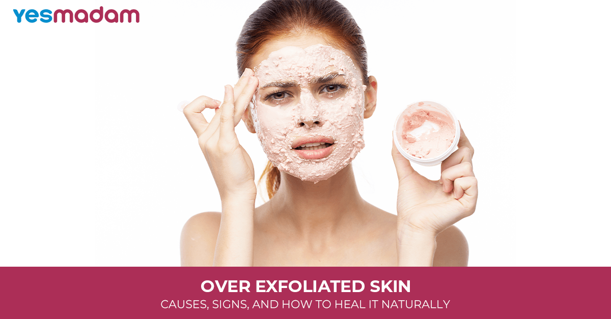 Over Exfoliated Skin: Causes, Signs, and How to Heal It Naturally