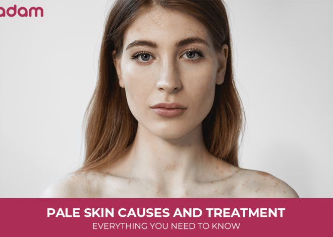 Pale Skin Causes and Treatment: Everything You Need to Know