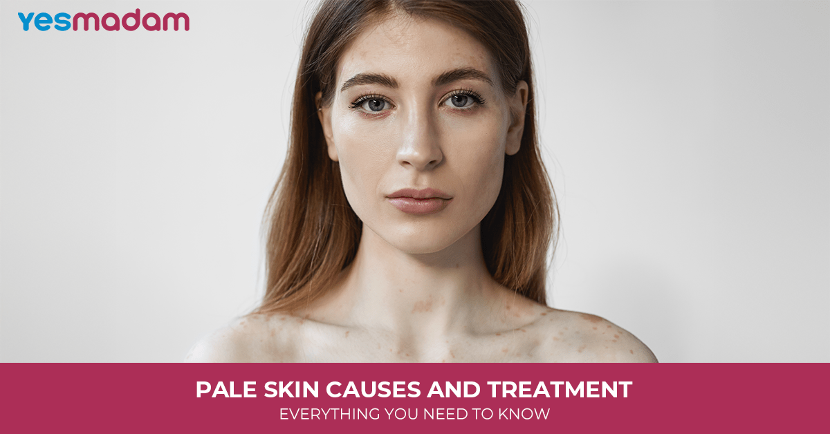 Pale Skin Causes and Treatment: Everything You Need to Know