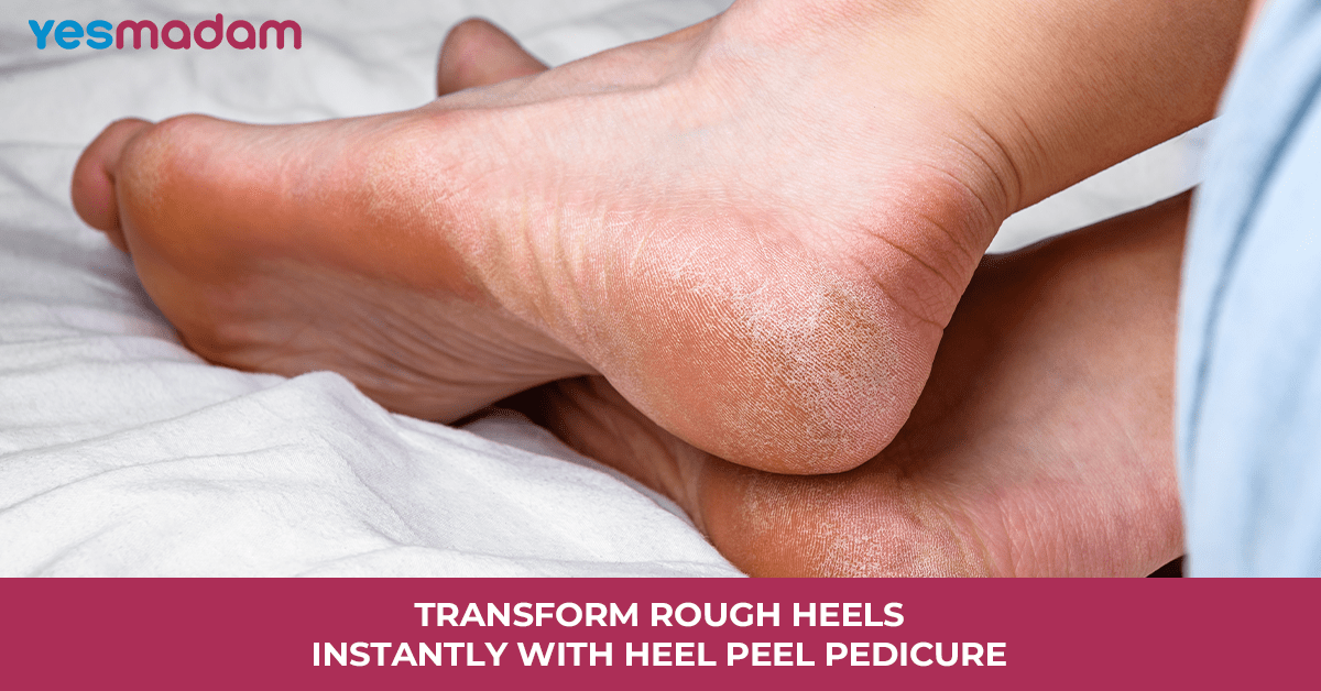 Transform Rough Heels Instantly With Heel Peel Pedicure