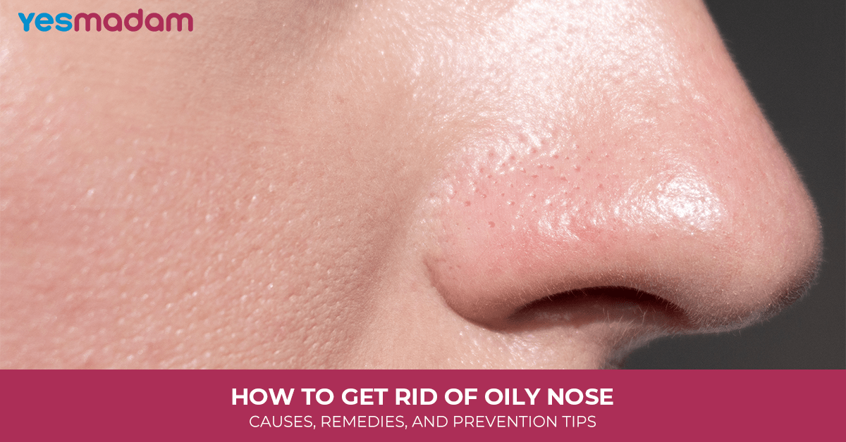 How to Get Rid of Oily Nose: Causes, Remedies, and Prevention Tips