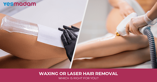 Waxing or Laser Hair Removal: Which Is Right for You?