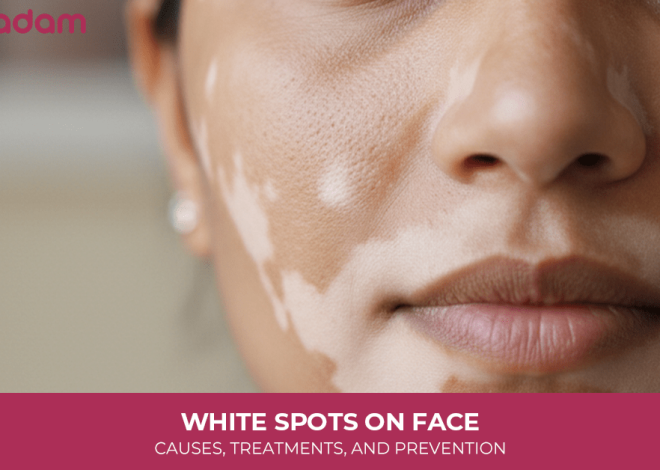 White Spots on Face: Causes, Treatments, and Prevention