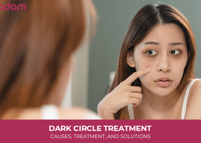 Dark Circle Treatment: Causes, Treatment, and Solutions