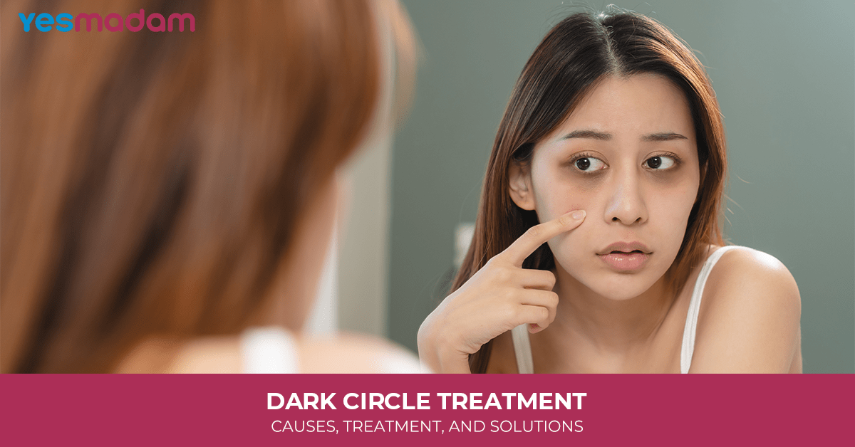 Dark Circle Treatment: Causes, Treatment, and Solutions