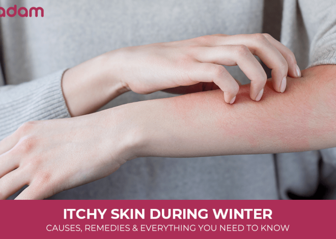 Itchy Skin During Winter: Causes, Remedies & Everything You Need to Know