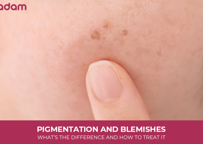 Pigmentation And Blemishes: What’s The Difference And How To Treat It