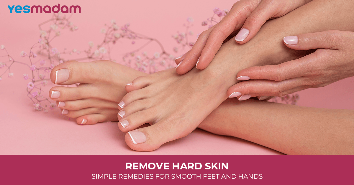 Remove Hard Skin: Simple Remedies For Smooth Feet And Hands