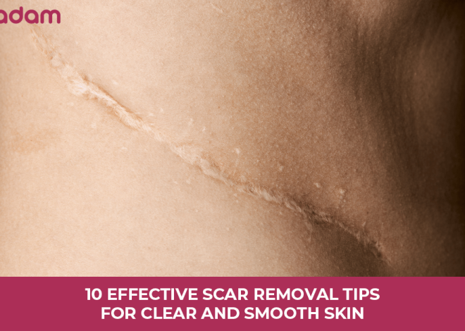 10 Effective Scar Removal Tips For Clear And Smooth Skin